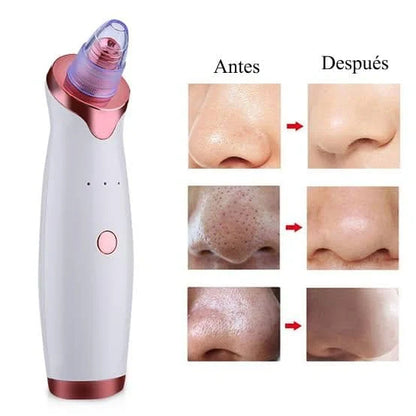 PoreClean Pro® + KIT DE REGALO